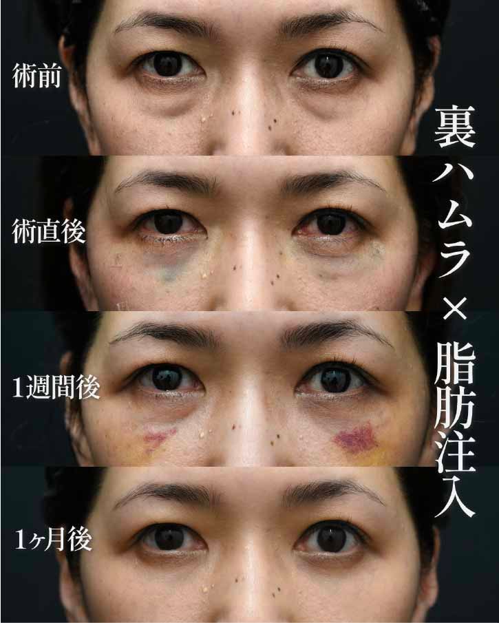 40代女性